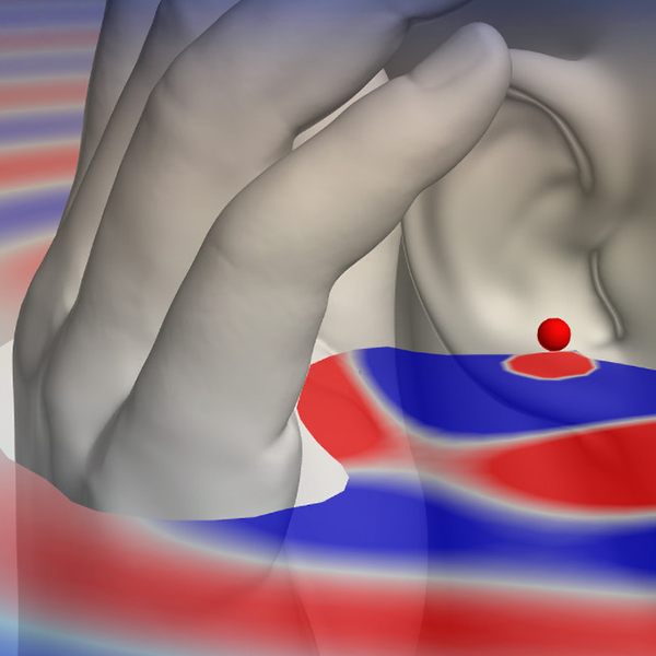 Vibro Acoustics image